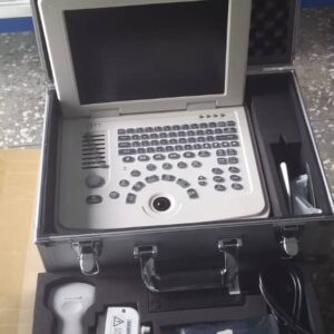 Laptop Ultrasound Machine in Lagos